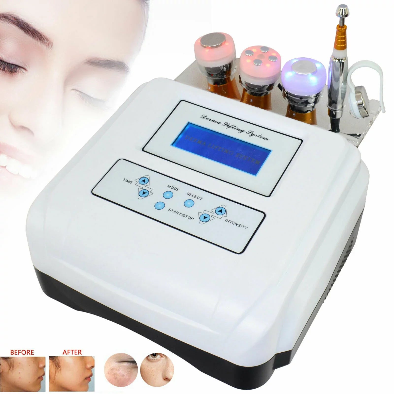 Cryo Electroporation No Needle Mesotherapy Skin Lift Wrinkle Removal Machine Spa