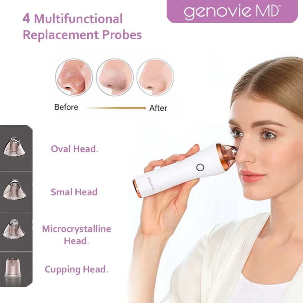 Genovie  Acne and Deep Pore Cleansing Kit for Face, Acne Remover, Blackhead Remover, Facial Skin Treatment, Vacuum Suction